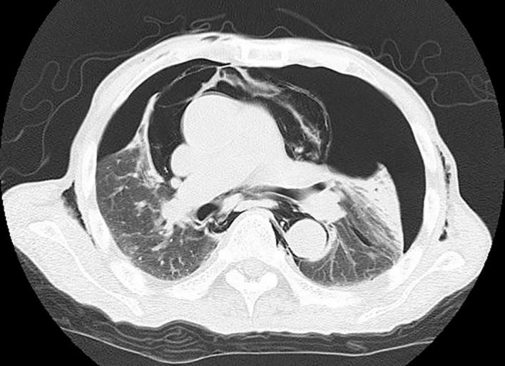 https://cdn.ncbi.nlm.nih.gov/pmc/blobs/93d8/5742383/dd1f615f6f29/1349-7235-56-3135-g003.jpg