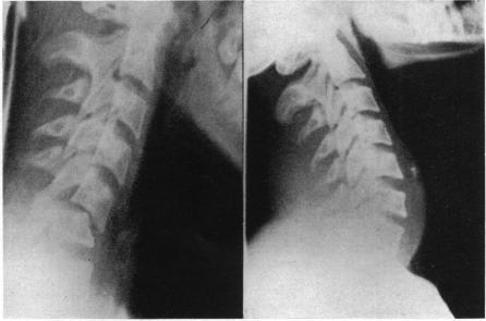 https://cdn.ncbi.nlm.nih.gov/pmc/blobs/93d9/1390629/aa6cb9c9f146/annsurg00527-0296-a.jpg