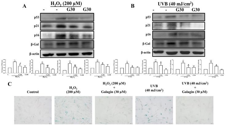 https://cdn.ncbi.nlm.nih.gov/pmc/blobs/93dd/8836071/c6cbbaeb3ddc/ijms-23-01387-g005.jpg