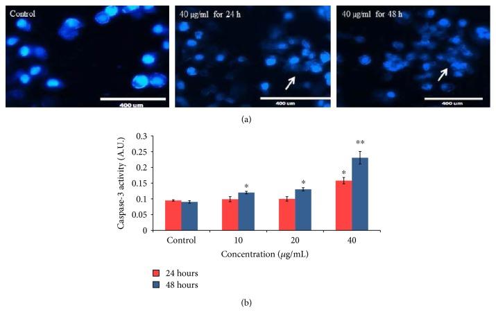 https://cdn.ncbi.nlm.nih.gov/pmc/blobs/93df/5534296/7aade7c34959/OMCL2017-8439098.006.jpg
