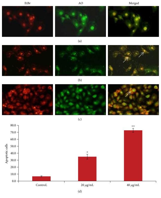 https://cdn.ncbi.nlm.nih.gov/pmc/blobs/93df/5534296/9143640bb01c/OMCL2017-8439098.007.jpg