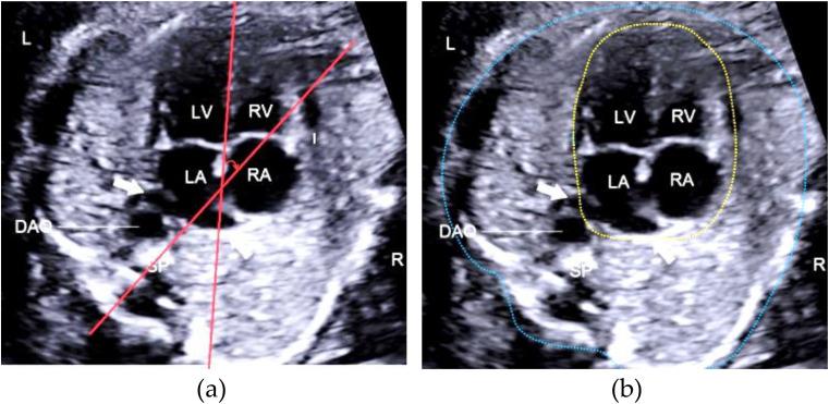 https://cdn.ncbi.nlm.nih.gov/pmc/blobs/93e7/11106923/37fa9afc6acb/12911_2024_2527_Fig1_HTML.jpg