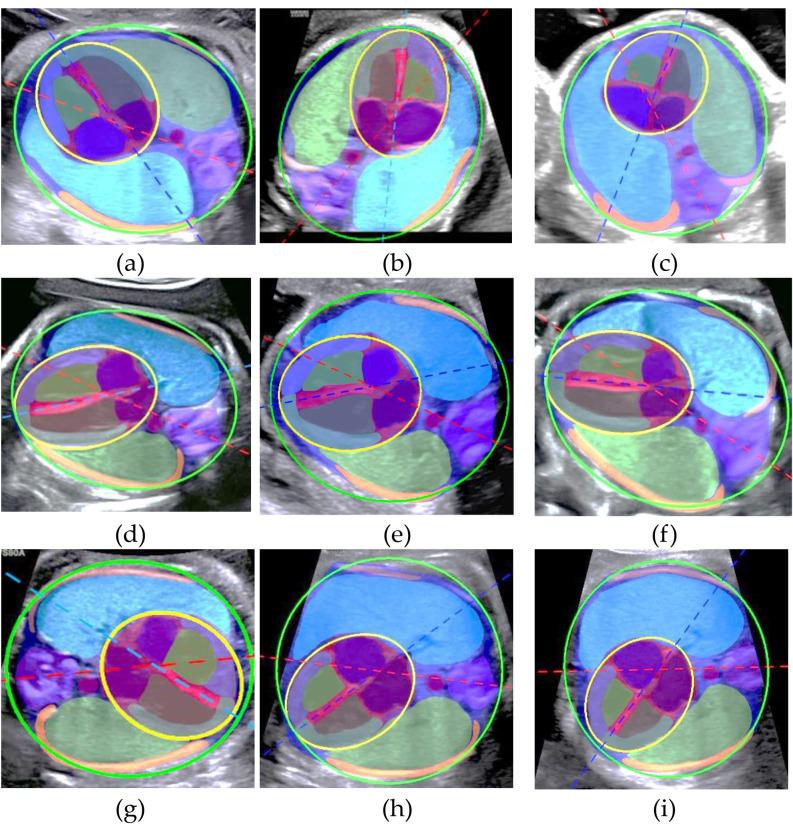 https://cdn.ncbi.nlm.nih.gov/pmc/blobs/93e7/11106923/5168d0895d1d/12911_2024_2527_Fig7_HTML.jpg