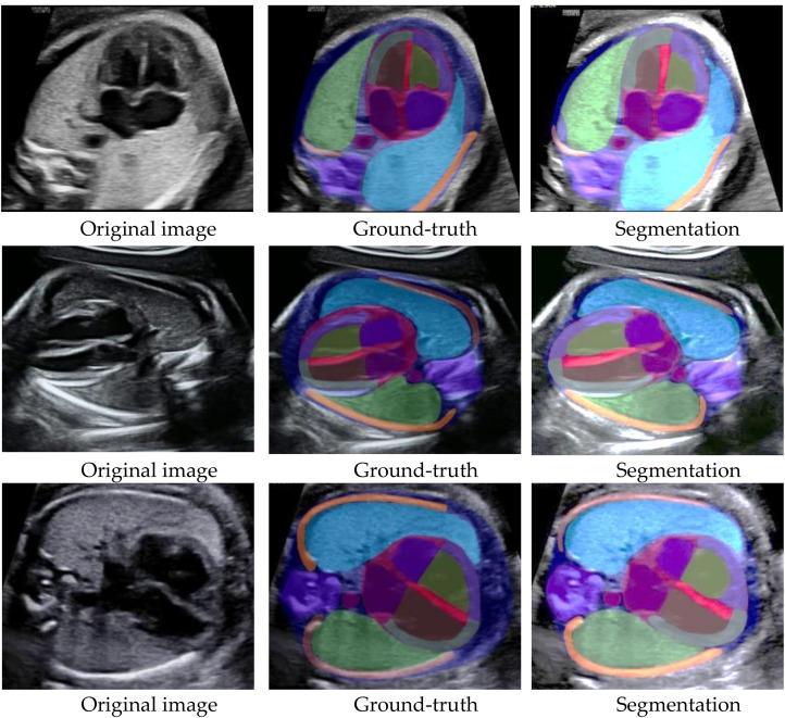 https://cdn.ncbi.nlm.nih.gov/pmc/blobs/93e7/11106923/91958c9f09a3/12911_2024_2527_Fig5_HTML.jpg