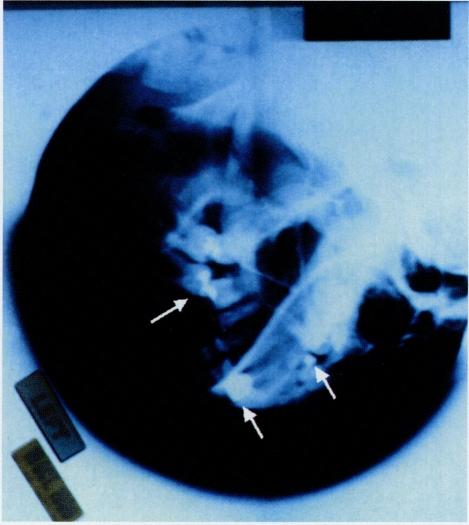 https://cdn.ncbi.nlm.nih.gov/pmc/blobs/93f0/2594485/7e479d5f7f55/jnma00314-0086-a.jpg