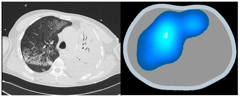 https://cdn.ncbi.nlm.nih.gov/pmc/blobs/93f5/11277617/b176600343db/jpm-14-00677-g006.jpg