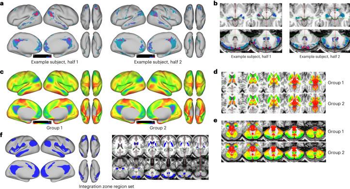 https://cdn.ncbi.nlm.nih.gov/pmc/blobs/93f6/11089006/bf61bfa0a9d6/41593_2024_1596_Fig7_HTML.jpg