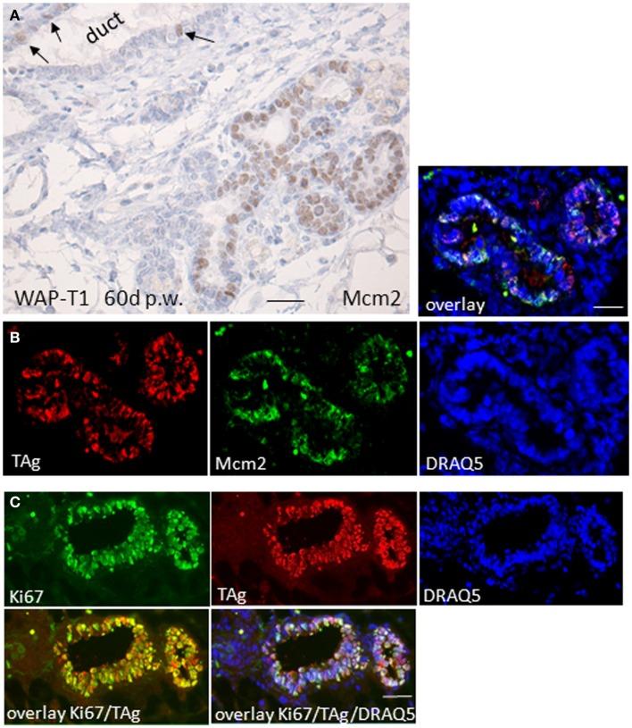 https://cdn.ncbi.nlm.nih.gov/pmc/blobs/93ff/4071642/3b8a6c4da573/fonc-04-00168-g004.jpg