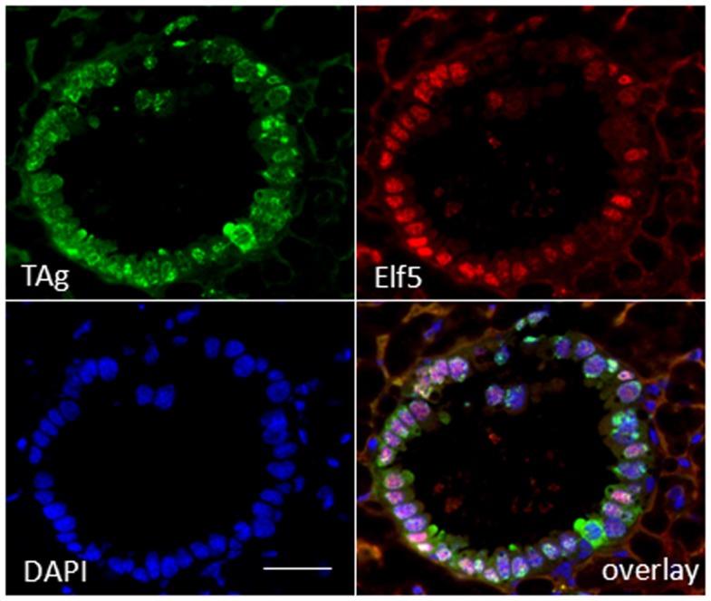 https://cdn.ncbi.nlm.nih.gov/pmc/blobs/93ff/4071642/84ad5f9c7a29/fonc-04-00168-g003.jpg