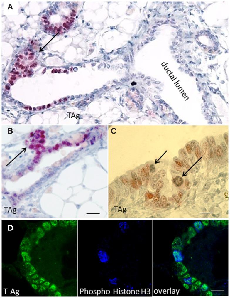 https://cdn.ncbi.nlm.nih.gov/pmc/blobs/93ff/4071642/8862a6d19760/fonc-04-00168-g001.jpg
