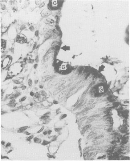 https://cdn.ncbi.nlm.nih.gov/pmc/blobs/9400/1777158/22ed7e50a332/archdisch00725-0055-a.jpg