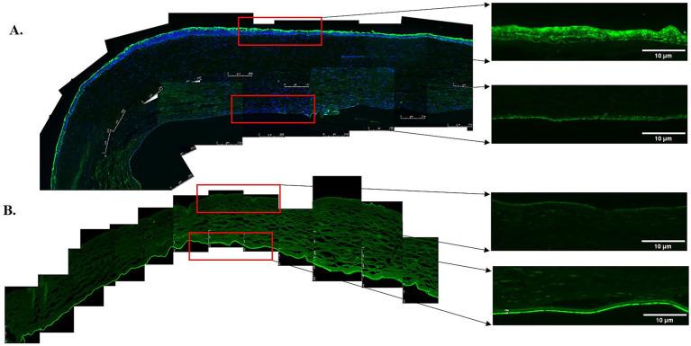 https://cdn.ncbi.nlm.nih.gov/pmc/blobs/9401/12361212/1baf35842806/fmed-12-1612452-g002.jpg