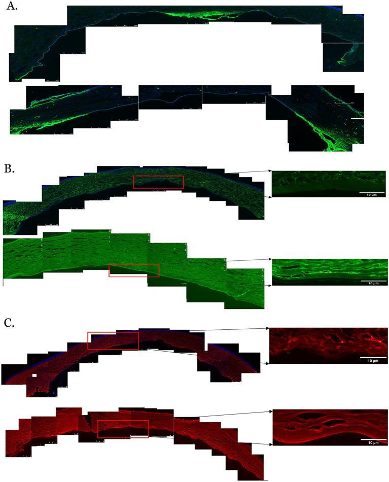 https://cdn.ncbi.nlm.nih.gov/pmc/blobs/9401/12361212/3ba8231f9750/fmed-12-1612452-g003.jpg