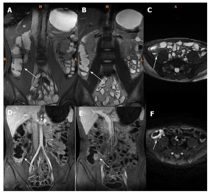 https://cdn.ncbi.nlm.nih.gov/pmc/blobs/9408/5989242/5bee328363c1/WJG-24-2279-g002.jpg