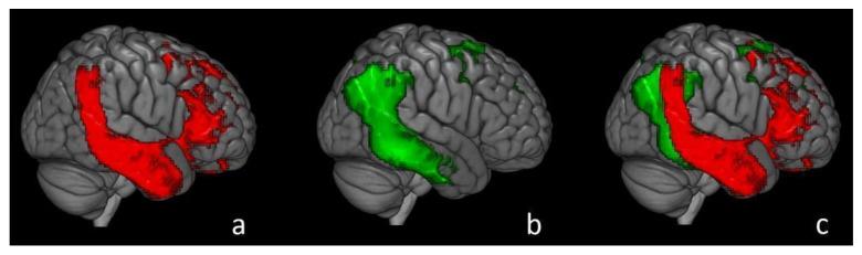 https://cdn.ncbi.nlm.nih.gov/pmc/blobs/940c/8657996/75cb297f5ed8/ijms-22-13002-g001.jpg
