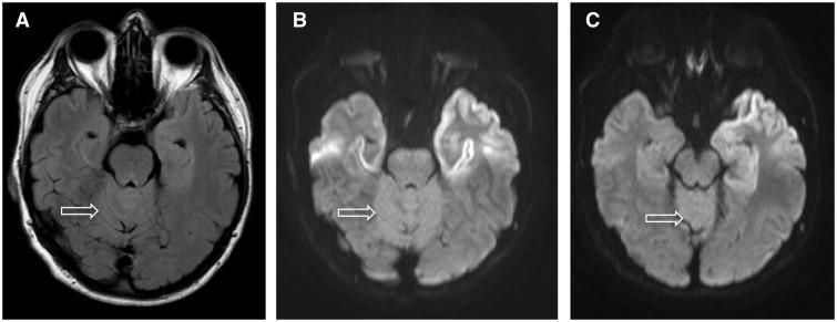 https://cdn.ncbi.nlm.nih.gov/pmc/blobs/940f/4620512/b7e8dbc93424/awv235f3p.jpg