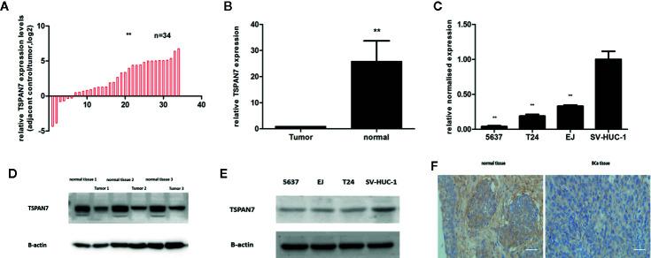 https://cdn.ncbi.nlm.nih.gov/pmc/blobs/9415/7821430/5158c5716130/fonc-10-613869-g002.jpg
