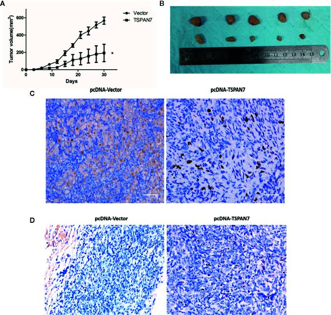 https://cdn.ncbi.nlm.nih.gov/pmc/blobs/9415/7821430/ef029da3c999/fonc-10-613869-g008.jpg
