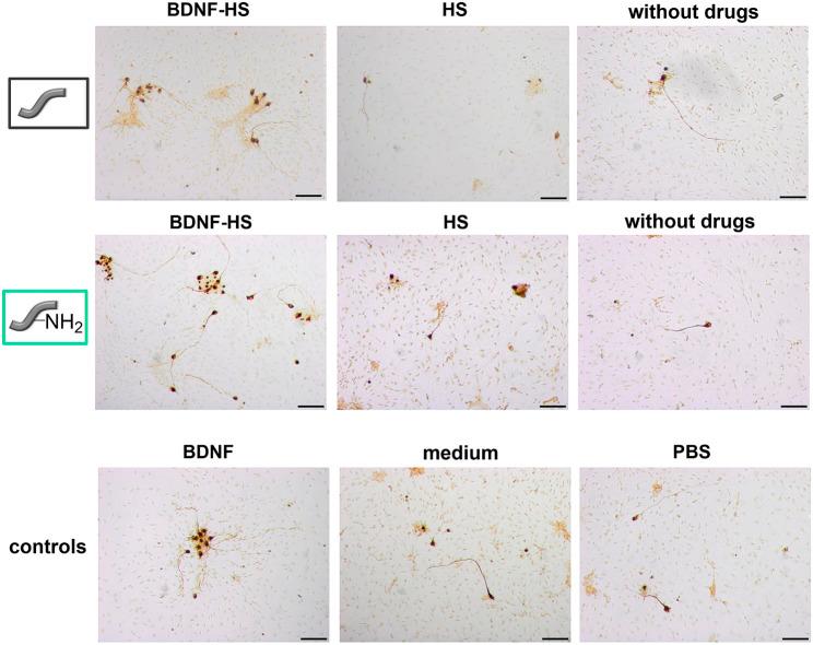 https://cdn.ncbi.nlm.nih.gov/pmc/blobs/941c/8819688/d2abc0abf4fd/fbioe-10-776890-g012.jpg