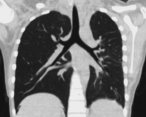 https://cdn.ncbi.nlm.nih.gov/pmc/blobs/941f/5294928/6a216e518e29/cp-2016-4-853-g004.jpg