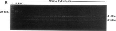 https://cdn.ncbi.nlm.nih.gov/pmc/blobs/9422/294170/3a6c2188d9c6/jcinvest00033-0200-b.jpg