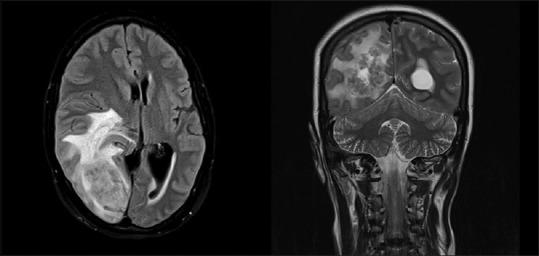 https://cdn.ncbi.nlm.nih.gov/pmc/blobs/942c/6130152/1cf99594e828/SNI-9-178-g001.jpg