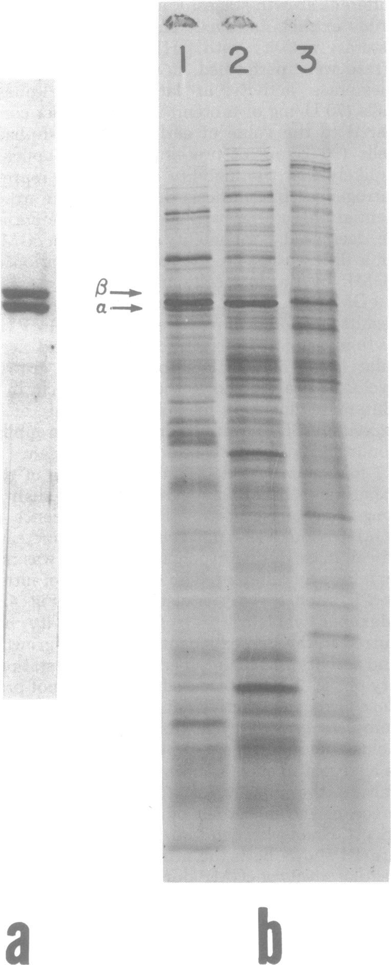 https://cdn.ncbi.nlm.nih.gov/pmc/blobs/942d/216853/bb23b82c5164/jbacter00278-0270-b.jpg