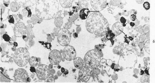 https://cdn.ncbi.nlm.nih.gov/pmc/blobs/942e/1965392/ae05e9988bce/amjpathol00263-0057-b.jpg