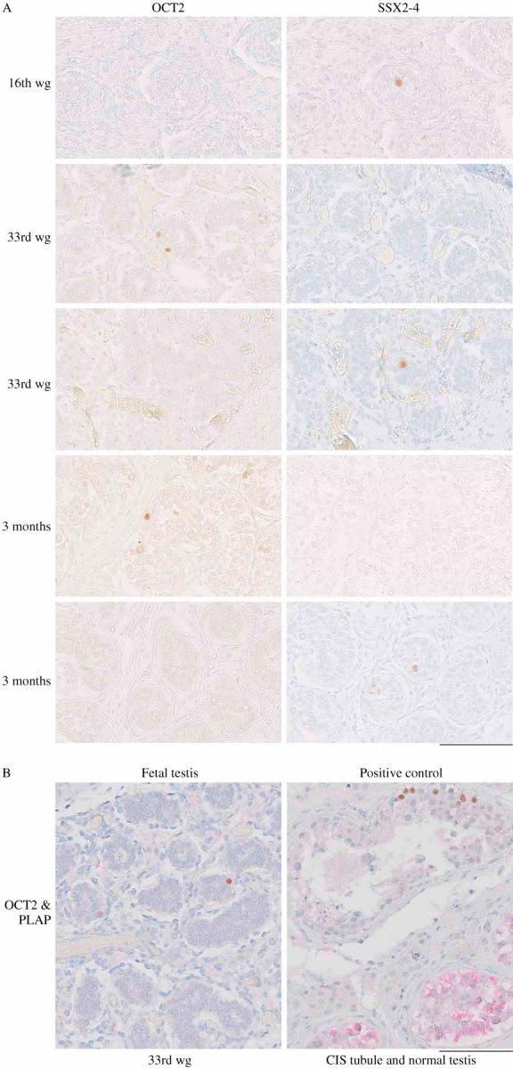 https://cdn.ncbi.nlm.nih.gov/pmc/blobs/942e/3210831/49528fff00c2/path0224-0473-f2.jpg