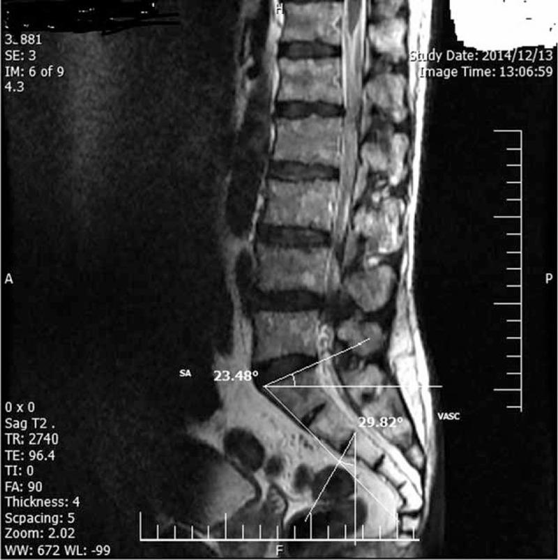 https://cdn.ncbi.nlm.nih.gov/pmc/blobs/9433/4753917/cbe68666a81e/medi-95-e2746-g004.jpg