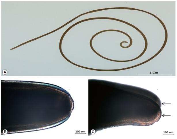 https://cdn.ncbi.nlm.nih.gov/pmc/blobs/9434/4725239/b5cb1a9431c3/kjp-53-6-719f1.jpg