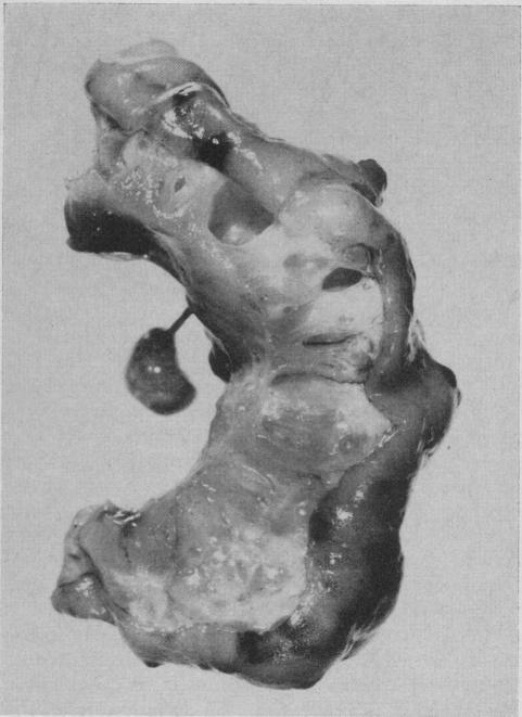 https://cdn.ncbi.nlm.nih.gov/pmc/blobs/9435/1927377/35fca8a796cc/canmedaj01059-0029-b.jpg