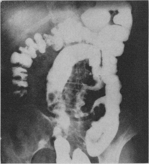 https://cdn.ncbi.nlm.nih.gov/pmc/blobs/9435/1927377/3eba2b663ad6/canmedaj01059-0030-c.jpg