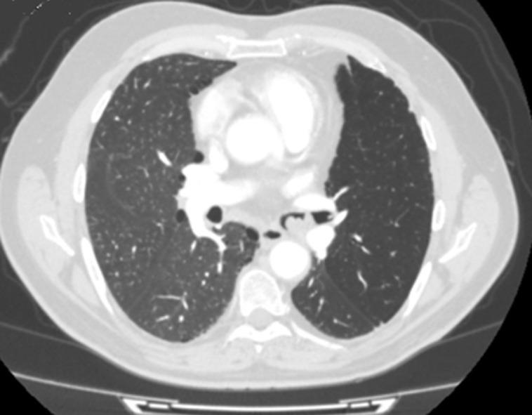 https://cdn.ncbi.nlm.nih.gov/pmc/blobs/943b/7813657/d3c44b8c45ef/PAMJ-37-201-g003.jpg