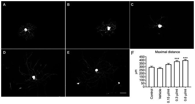 https://cdn.ncbi.nlm.nih.gov/pmc/blobs/943e/8889531/b9a53892b272/br-16-04-01513-g00.jpg