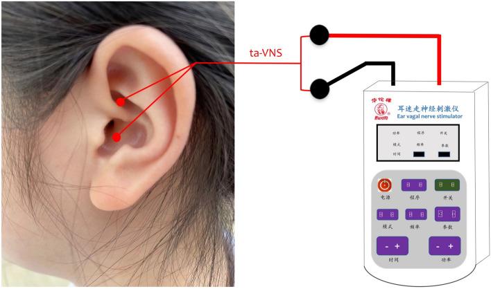 https://cdn.ncbi.nlm.nih.gov/pmc/blobs/9441/10182028/a028e475ac8e/41598_2023_34746_Fig1_HTML.jpg
