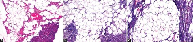 https://cdn.ncbi.nlm.nih.gov/pmc/blobs/9448/4774288/128eb2c63d71/JOMFP-19-342-g009.jpg