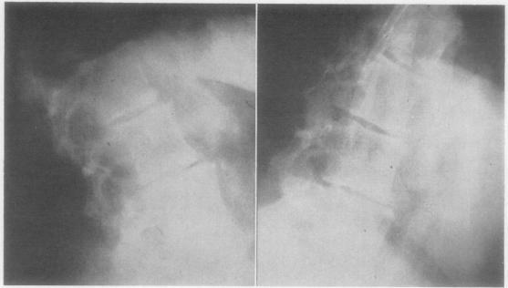 https://cdn.ncbi.nlm.nih.gov/pmc/blobs/944b/1030893/434322397727/annrheumd00212-0023-a.jpg