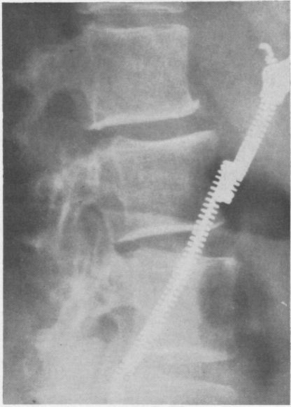 https://cdn.ncbi.nlm.nih.gov/pmc/blobs/944b/1030893/6c4fc9a57871/annrheumd00212-0016-a.jpg