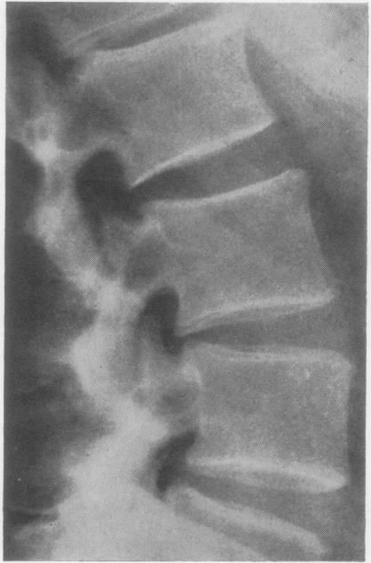 https://cdn.ncbi.nlm.nih.gov/pmc/blobs/944b/1030893/abfec51081e2/annrheumd00212-0019-a.jpg