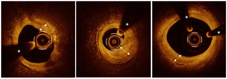 https://cdn.ncbi.nlm.nih.gov/pmc/blobs/944c/11477163/b1da5504c6f4/jcm-13-05791-g004.jpg