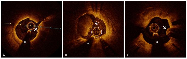 https://cdn.ncbi.nlm.nih.gov/pmc/blobs/944c/11477163/f6ad32807501/jcm-13-05791-g006.jpg