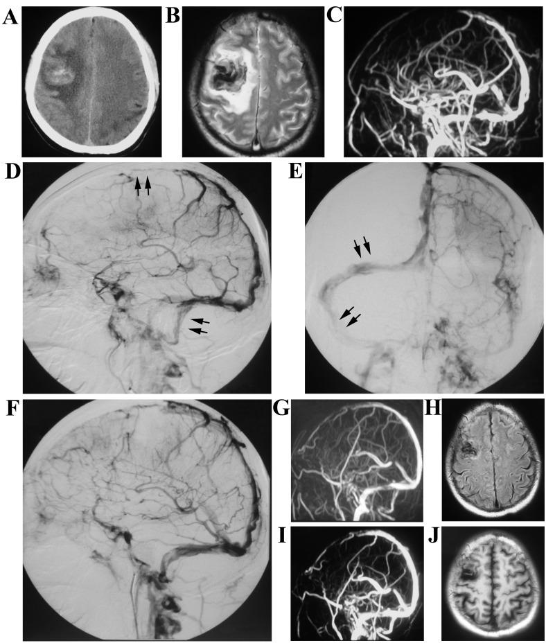 https://cdn.ncbi.nlm.nih.gov/pmc/blobs/9454/5647711/5558d222c763/etm-14-05-3961-g02.jpg