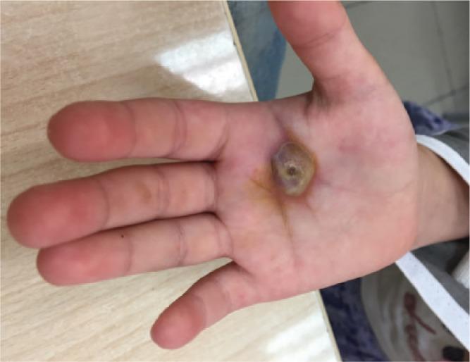 https://cdn.ncbi.nlm.nih.gov/pmc/blobs/945d/6540949/c6cfe3ce459f/eor-4-183-g002.jpg