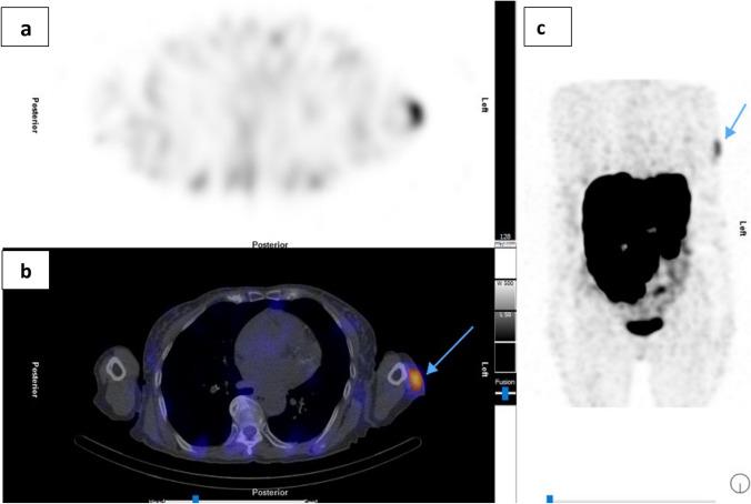https://cdn.ncbi.nlm.nih.gov/pmc/blobs/945d/9362710/372536e340e5/40336_2022_519_Fig2_HTML.jpg