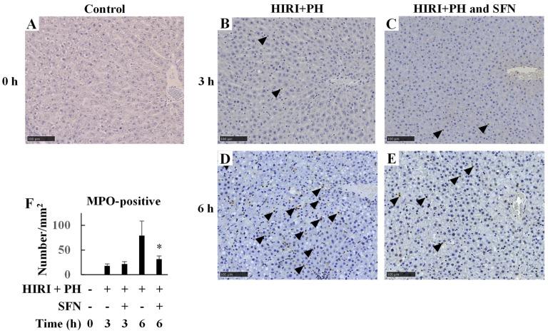 https://cdn.ncbi.nlm.nih.gov/pmc/blobs/9460/10778753/a993b4ba24ba/ijms-25-00579-g004.jpg
