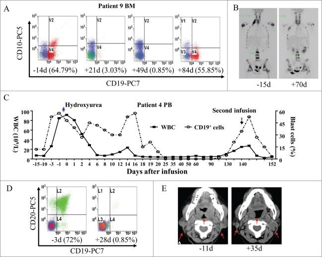 https://cdn.ncbi.nlm.nih.gov/pmc/blobs/946b/4590028/455455815c49/koni-04-11-1027469-g004.jpg