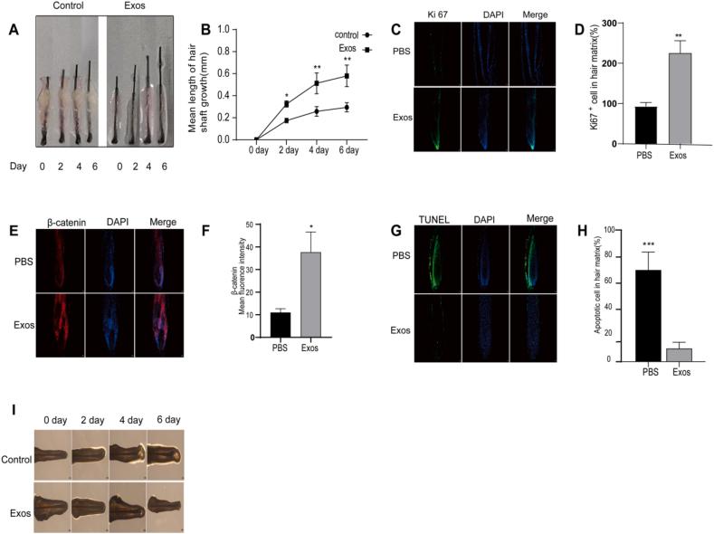 https://cdn.ncbi.nlm.nih.gov/pmc/blobs/946c/12144913/6fb67a3df2be/gr5.jpg