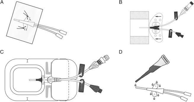 https://cdn.ncbi.nlm.nih.gov/pmc/blobs/946c/4893865/08101fef546b/bmjopen2016011197f01.jpg
