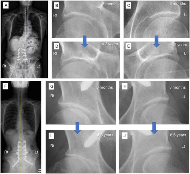 https://cdn.ncbi.nlm.nih.gov/pmc/blobs/9475/12254317/0bdb07e1ad94/41598_2025_10806_Fig6_HTML.jpg